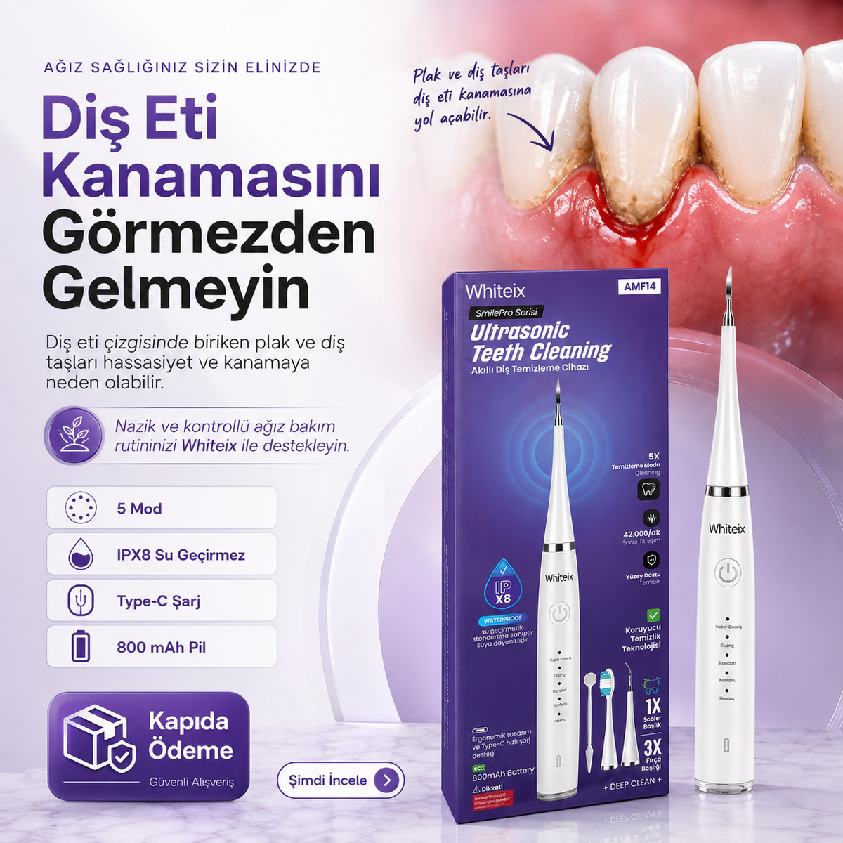 Ultrasonik Diş Taşı Temizleme Cihazı